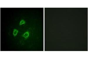 Immunofluorescence analysis of HepG2 cells, using Kv2.