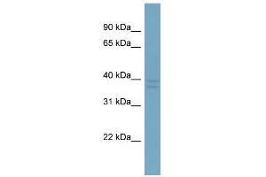 anti-Chromosome X Open Reading Frame 66 (CXorf66) (Middle Region) antibody