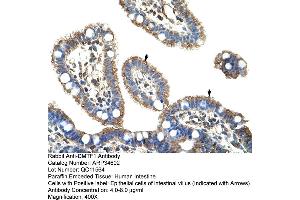 Image no. 1 for anti-Cyclin D Binding Myb-Like Transcription Factor 1 (DMTF1) (C-Term) antibody (ABIN2775903)