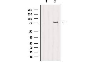 Image no. 3 for anti-NDC80 Kinetochore Complex Component Homolog (NDC80) antibody (ABIN6263548)