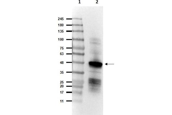 SARS-Coronavirus Nucleocapsid Protein (SARS-CoV N) antibody