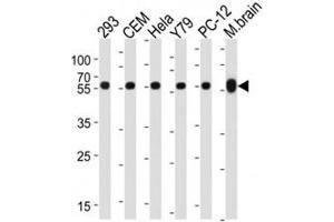 Image no. 4 for anti-Tubulin, beta 1 (TUBB1) antibody (ABIN3029340)