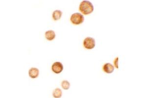 Image no. 2 for anti-CASK Interacting Protein 2 (CASKIN2) (N-Term) antibody (ABIN6655449)