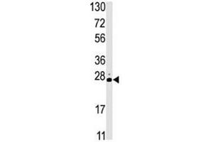 Image no. 1 for anti-serine/threonine Kinase 19 (STK19) (AA 278-308) antibody (ABIN3029004)