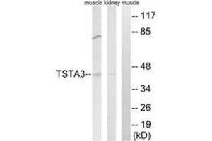 Image no. 1 for anti-Tissue Specific Transplantation Antigen P35B (TSTA3) (AA 221-270) antibody (ABIN1534938)