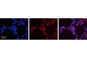 Image no. 3 for anti-Surfactant Protein B (SFTPB) (Middle Region) antibody (ABIN2776796)