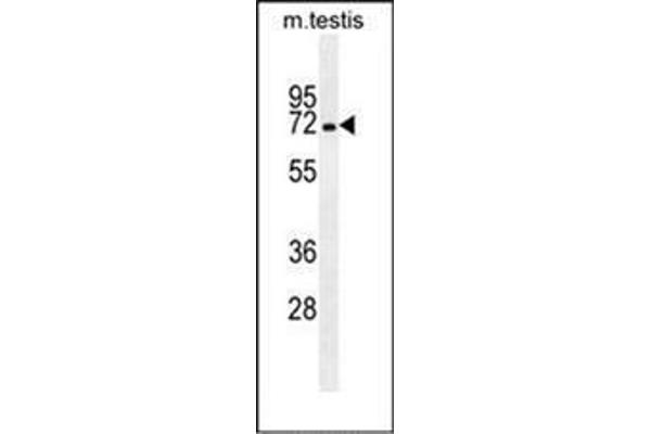 MBTD1 抗体  (C-Term)