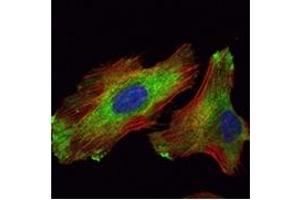 Image no. 2 for anti-WNT Inhibitory Factor 1 (WIF1) antibody (ABIN1109510)