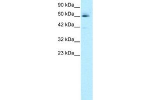 Image no. 8 for anti-Hematopoietic Cell-Specific Lyn Substrate 1 (HCLS1) (N-Term) antibody (ABIN2777503)