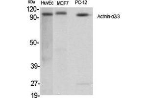 Western Blot (WB) analysis of specific cells using Actinin-alpha2/3 Polyclonal Antibody.