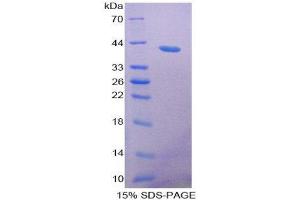Image no. 1 for Resistin Like beta (RETNLB) (AA 24-105) protein (His tag,GST tag) (ABIN1981239)