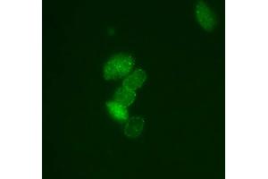 Image no. 3 for anti-Small Ubiquitin Related Modifier Protein 1 (SUMO1) (full length) antibody (ABIN2452138)
