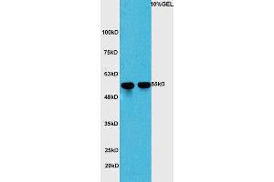 Image no. 4 for anti-Yes-Associated Protein 1 (YAP1) (AA 131-330) antibody (ABIN701485)