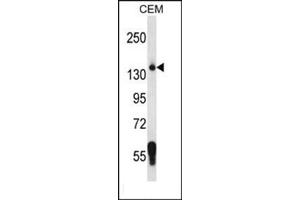 Image no. 1 for anti-Splicing Factor 3b, Subunit 3, 130kDa (SF3B3) (AA 1053-1082), (C-Term) antibody (ABIN954757)