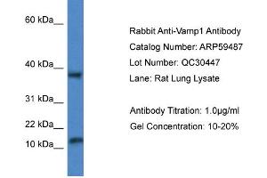 Image no. 1 for anti-Vesicle-Associated Membrane Protein 1 (Synaptobrevin 1) (VAMP1) (Middle Region) antibody (ABIN2788088)