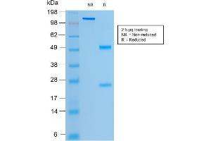 Image no. 1 for anti-Cystic Fibrosis Transmembrane Conductance Regulator (ATP-Binding Cassette Sub-Family C, Member 7) (CFTR) antibody (ABIN6939094)
