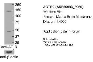 Image no. 2 for anti-Angiotensin II Receptor, Type 2 (AGTR2) (N-Term) antibody (ABIN2788290)