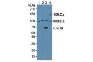 Image no. 2 for anti-ADAM Metallopeptidase Domain 8 (ADAM8) (AA 145-493) antibody (ABIN1866534)