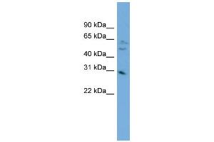 Image no. 2 for anti-mRNA Turnover 4 Homolog (MRTO4) (Middle Region) antibody (ABIN2782556)