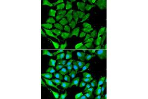 Image no. 3 for anti-Peroxisome Proliferator-Activated Receptor gamma (PPARG) (N-Term) antibody (ABIN3020844)