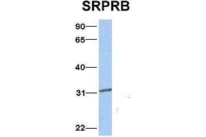 Image no. 4 for anti-Signal Recognition Particle Receptor, B Subunit (SRPRB) (Middle Region) antibody (ABIN2783830)