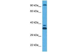 Image no. 2 for anti-Zinc Finger Protein, X-Linked (ZFX) (N-Term) antibody (ABIN2780506)