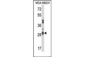Image no. 2 for anti-Glutathione S-Transferase alpha 2 (GSTa2) (AA 1-30), (N-Term) antibody (ABIN952640)