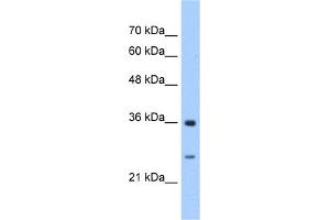 Image no. 1 for anti-Glutathione Transferase zeta 1 (Maleylacetoacetate Isomerase) (GSTZ1) (N-Term) antibody (ABIN2783617)