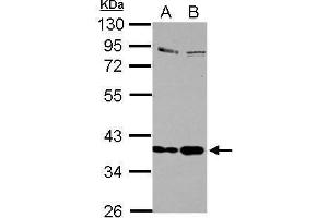Image no. 1 for anti-Selenoprotein P (SEPP1) (Center) antibody (ABIN2856147)