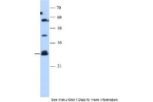 Image no. 4 for anti-Suppressor of Cytokine Signaling 1 (SOCS1) (N-Term) antibody (ABIN2777164)