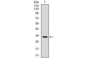 Image no. 4 for anti-Tumor Necrosis Factor Receptor Superfamily, Member 8 (TNFRSF8) antibody (ABIN969019)