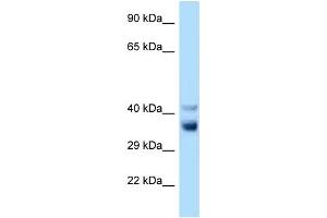 Image no. 1 for anti-NEK7 (NEK7) (C-Term) antibody (ABIN2783600)