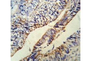 PCSK9 anticorps  (AA 479-508)