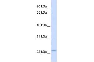 Image no. 1 for anti-Receptor Accessory Protein 1 (REEP1) (C-Term) antibody (ABIN636040)