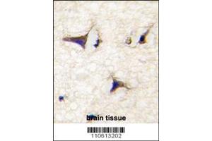 Immunohistochemistry (IHC) image for anti-Dishevelled Associated Activator of Morphogenesis 2 (DAAM2) antibody (ABIN2158478)