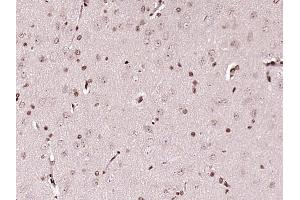 Paraformaldehyde-fixed, paraffin embedded rat brain tissue Antigen retrieval by boiling in sodium citrate buffer (pH6.