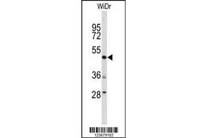 Western Blotting (WB) image for anti-DEK Oncogene (DEK) antibody (ABIN2158523)