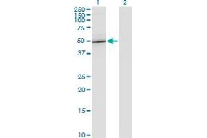 Western Blot analysis of GIT2 expression in transfected 293T cell line by GIT2 monoclonal antibody (M04), clone 1B2.