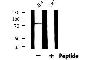 Image no. 1 for anti-Glucuronidase, beta (GUSB) (Internal Region) antibody (ABIN6256968)