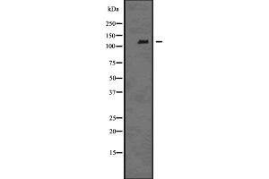 Image no. 3 for anti-EPH Receptor B6 (EPHB6) (Internal Region) antibody (ABIN6261571)