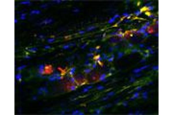 Sortilin 1 antibody  (Extracellular Domain)