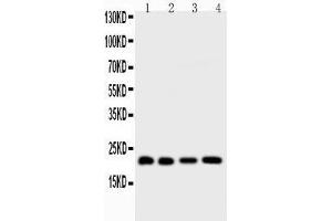 Image no. 3 for anti-BH3 Interacting Domain Death Agonist (BID) (AA 1-195) antibody (ABIN3042321)