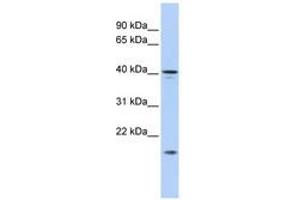 Image no. 1 for anti-SLAIN Motif Family, Member 1 (SLAIN1) (AA 221-270) antibody (ABIN6741157)