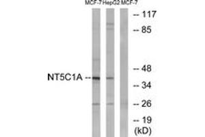 Image no. 1 for anti-5'-Nucleotidase, Cytosolic IA (NT5C1A) (AA 151-200) antibody (ABIN1534814)