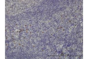 Image no. 2 for anti-Transcription Factor 12 (TCF12) (AA 364-453) antibody (ABIN563120)