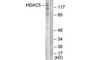 Image no. 2 for anti-Histone Deacetylase 5 (HDAC5) (AA 1073-1122) antibody (ABIN1533305)