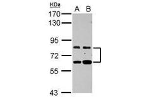 Image no. 1 for anti-Zinc Finger Protein 64 (ZFP64) (AA 394-681) antibody (ABIN1501818)
