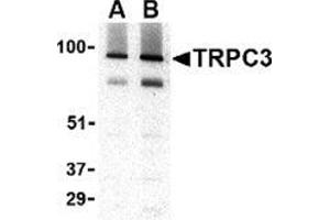 Image no. 2 for anti-Transient Receptor Potential Cation Channel, Subfamily C, Member 3 (TRPC3) (C-Term) antibody (ABIN501062)
