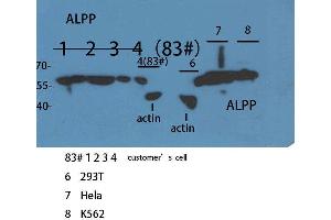 Image no. 1 for anti-Placental Alkaline Phosphatase (ALPP) (N-Term) antibody (ABIN3187883)