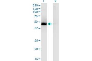 Image no. 1 for anti-Nuclear Receptor Subfamily 1, Group H, Member 3 (NR1H3) (AA 1-387) antibody (ABIN523441)